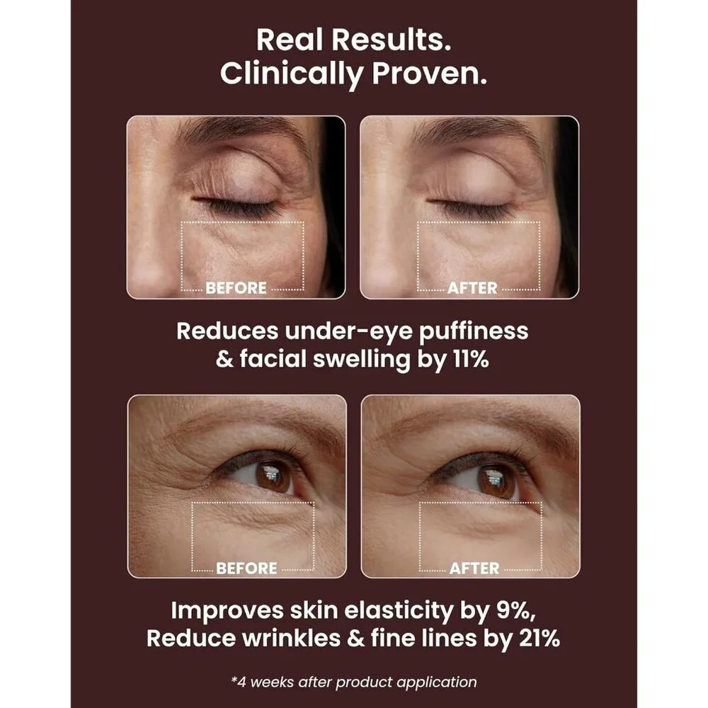 Ice Roll Serum Face Puffy Eyes Under Eye Bags & Collagen for Wrinkles 1.69 Fl Oz